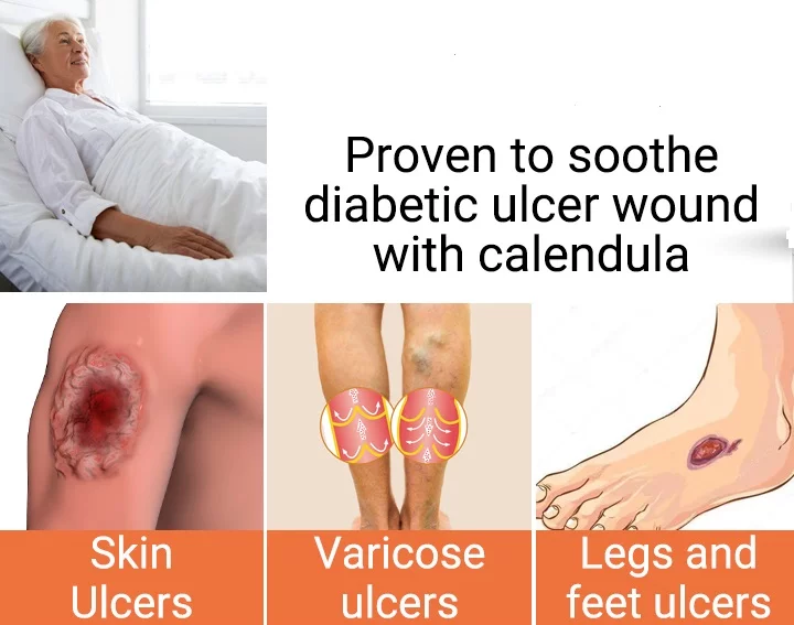 انواع زخم های وریدی