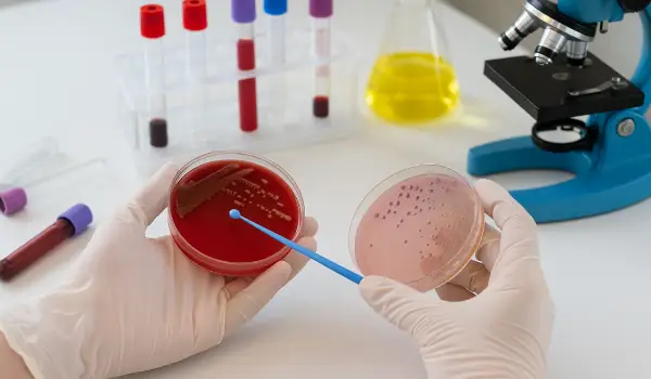 مراحل کشت زخم